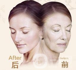 北京熱瑪吉價格