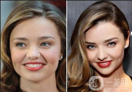 深圳去眼袋填淚溝手術一共需要多少錢