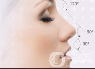 廣東駝峰鼻矯正費(fèi)用,駝峰鼻矯正費(fèi)用