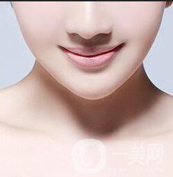 上海下頜角磨骨多少錢