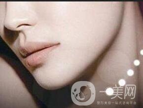 深圳墊下巴費用