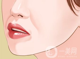 熱瑪吉去除法令紋