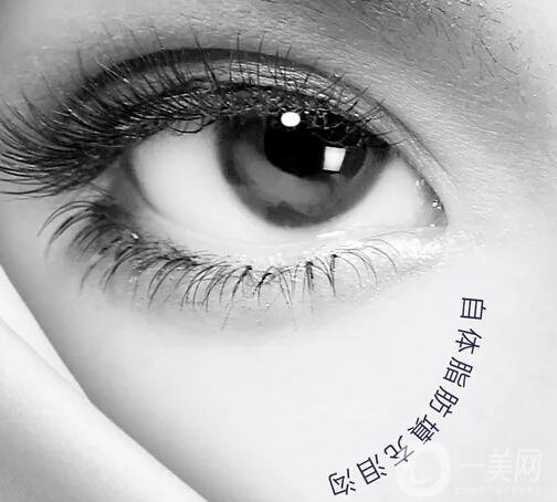 自體脂肪填充淚溝