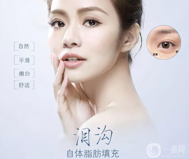 自體脂肪填充淚溝