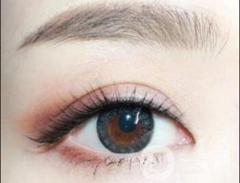 雙眼皮貴不貴,雙眼皮價格