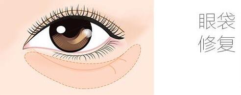*去眼袋修復(fù)價(jià)格