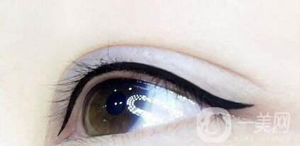 美瞳線修復(fù)的價(jià)格