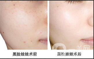 黑臉娃娃價(jià)格