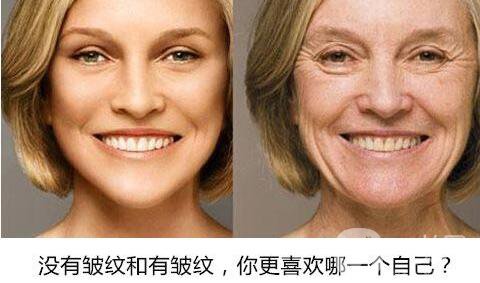 除皺方式 除皺價格