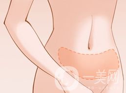腹部溶脂恢復(fù)過(guò)程