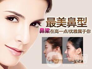 耳軟骨隆鼻手術(shù)多少錢