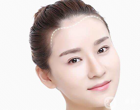 改發(fā)際線價格是多少？