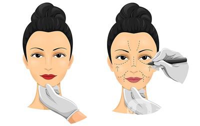 福州面部拉皮除皺價(jià)格是多少