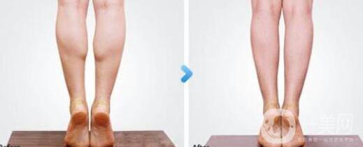 *多少錢(qián),**果