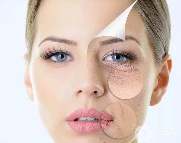 拉皮手術(shù)多少錢一次？