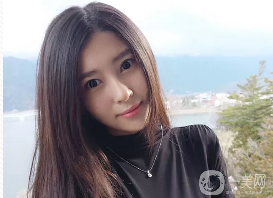 下頜角手術(shù)恢復(fù)多久 多久消腫呢