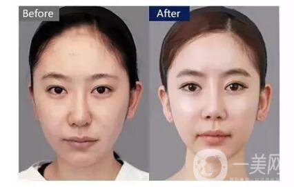 冬天應(yīng)該怎么護(hù)膚99%的人壓根就不知道，但這篇教你！