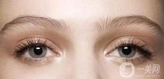 歐式雙眼皮貴嗎,歐式雙眼皮價(jià)格