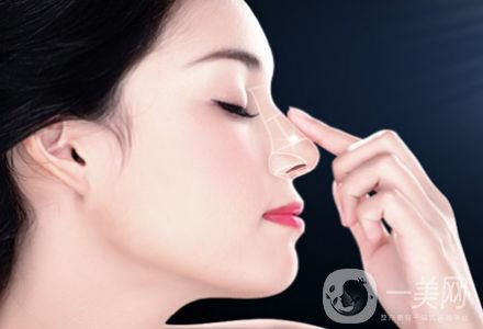 自體隆鼻手術(shù)價格 自體脂肪填充的方法