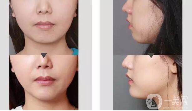 *的價位是多少 *有危害嗎