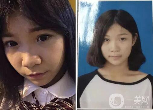 整容對人生的改變真的大嗎 整容后的人生變好了嗎