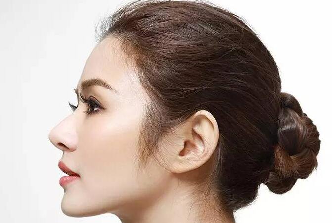 隆鼻手多少錢,隆鼻貴不貴