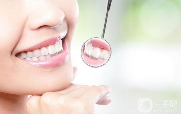 目前烤瓷牙種類有哪些？