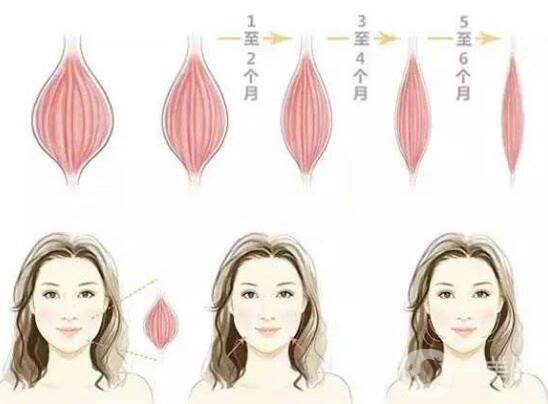 *能維持多長(zhǎng)時(shí)間 注射*注意事項(xiàng)