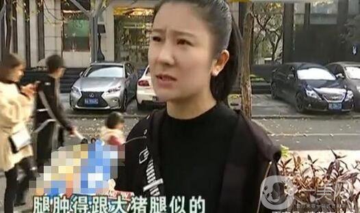 驚！女子花5萬整形，大腿留下17厘米疤痕