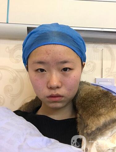 整容到底為了什么？知乎回答扎進心窩