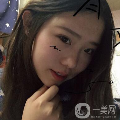 整容到底為了什么？知乎回答扎進心窩