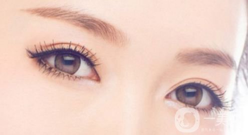 雙眼皮術(shù)后如何防止增生 雙眼皮術(shù)后護(hù)理