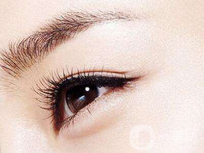 三點定位雙眼皮幾個月寬度定型 *嗎？