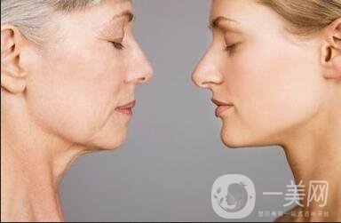 *面部提升術(shù)*果