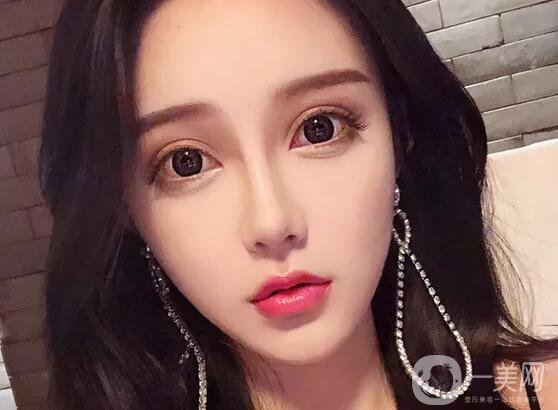 注射隆鼻好嗎 有哪些缺點(diǎn)呢？