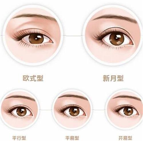 冬季割雙眼皮注意什么？術(shù)后吃什么好？