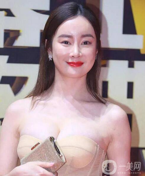 賈靜雯、迪麗熱巴的雙眼皮是不是割的 看了這個(gè)你就明白了