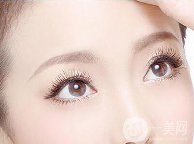 韓式*開(kāi)眼角價(jià)格