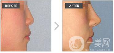 南京王志軍醫(yī)療美容診所價(jià)格表2019提前曝光