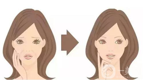 除皺多少錢 除皺的方法有哪些