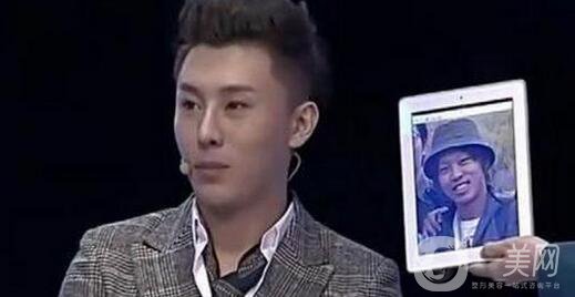 帥氣小伙9年整容*次 容顏今非昔比