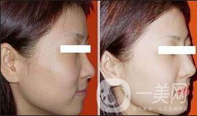 黑臉娃娃注意事項