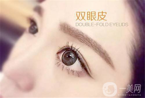 三點定位雙眼皮多少錢 雙眼皮手術(shù)方法