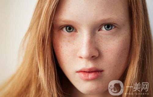 牛奶咖啡斑如何調(diào)節(jié) 祛斑方法有哪些