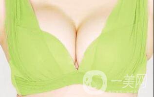 乳房下垂矯正風(fēng)險(xiǎn),乳房下垂矯正術(shù)后護(hù)理