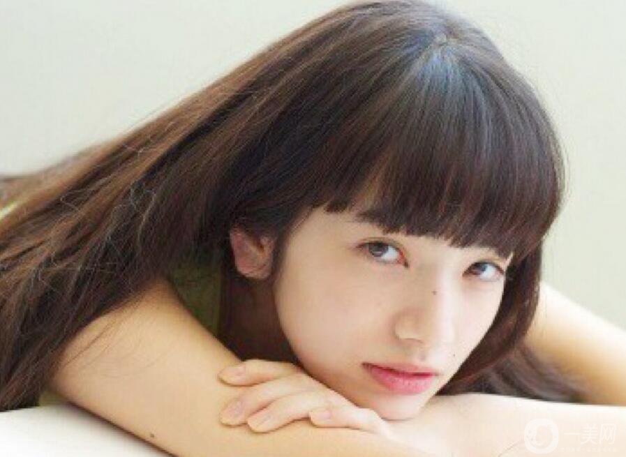 植發(fā)*果維持多久,植發(fā)注意事項(xiàng)