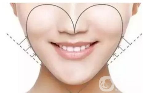 面部吸脂修復(fù)手術(shù)多少錢 面部吸脂恢復(fù)時間