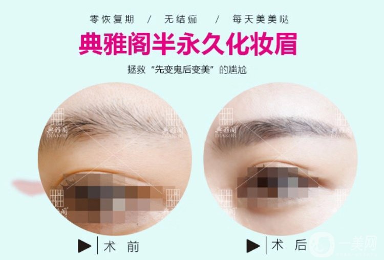 昆明典雅閣紋眉怎么樣？