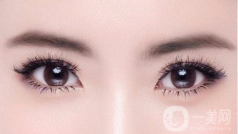 割雙眼皮的方法有哪些 什么時(shí)候消腫