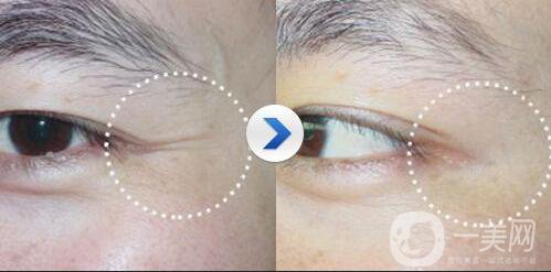 金瀚回應(yīng)丑帥男星，沒有整容的朱一龍也上榜了